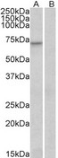 FOXO3 / FOXO3A Antibody - Goat Anti-FOXO3A / FOXO3 / FKHRL1 Antibody (0.3µg/ml) staining of Human Heart lysate (35µg protein in RIPA buffer) with (A) and without (B) blocking with the immunising peptide. Detected by chemiluminescencence.