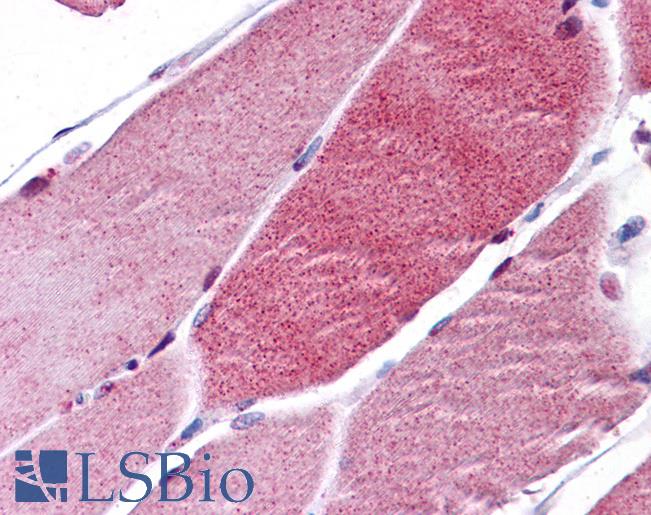 FOXO3 / FOXO3A Antibody - Anti-FOXO3A antibody IHC of human skeletal muscle. Immunohistochemistry of formalin-fixed, paraffin-embedded tissue after heat-induced antigen retrieval. Antibody concentration 5 ug/ml.