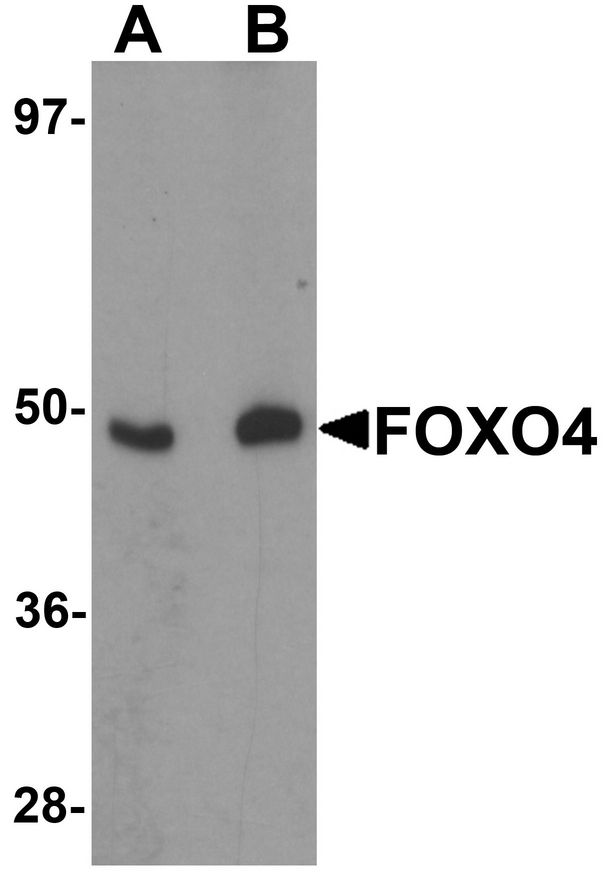 FOXO4 / AFX1 Antibody - Western blot analysis of FOXO4 in HeLa cell lysate with FOXO4 antibody at (A) 0.5 and (B) 1 ug/ml.