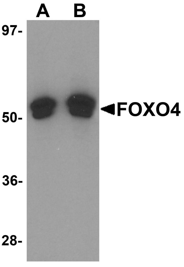FOXO4 / AFX1 Antibody - Western blot analysis of FOXO4 in A-20 cell lysate with FOXO4 antibody at (A) 0.5 and (B) 1 ug/ml.