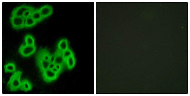 FPR1 / FPR Antibody - Immunofluorescence analysis of MCF7 cells, using FPR1 Antibody. The picture on the right is blocked with the synthesized peptide.