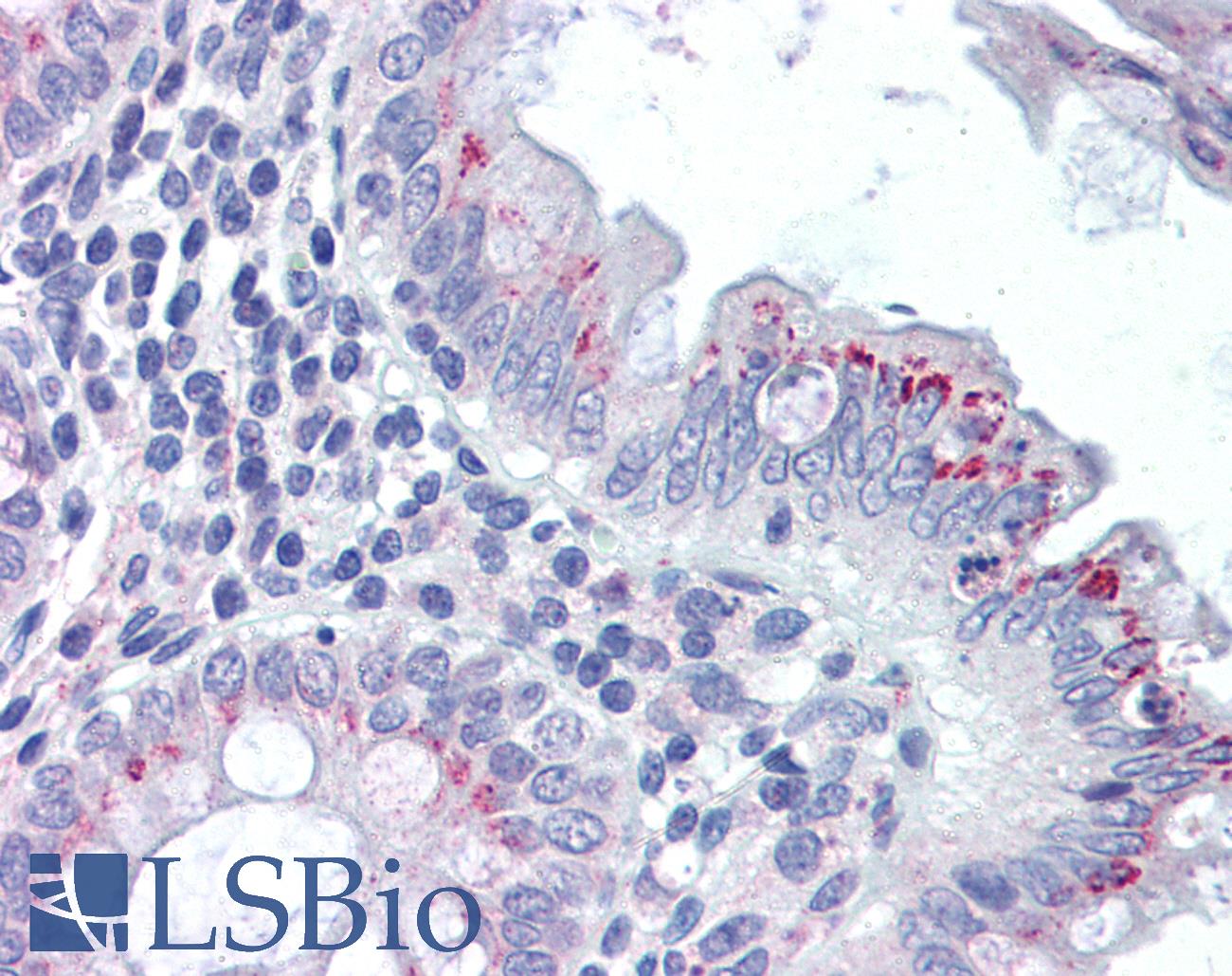 FPR2 / FPRL1 Antibody - Anti-FPR2 / FPRL1 antibody IHC of human colon. Immunohistochemistry of formalin-fixed, paraffin-embedded tissue after heat-induced antigen retrieval. Antibody concentration 5 ug/ml.