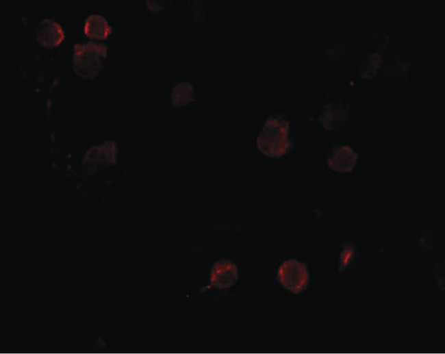 FREM1 Antibody - Immunofluorescence of FREM1 in K562 cells with FREM1 antibody at 20 ug/ml.