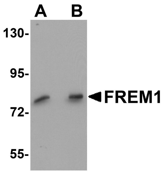 FREM1 Antibody - Western blot analysis of FREM1 in K562 cell lysate with FREM1 antibody at (A) 0.5 and (B) 1ug/ml.