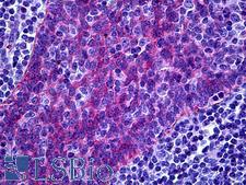 FREM1 Antibody - Anti-FREM1 antibody IHC of human tonsil. Immunohistochemistry of formalin-fixed, paraffin-embedded tissue after heat-induced antigen retrieval. Antibody concentration 10 ug/ml.