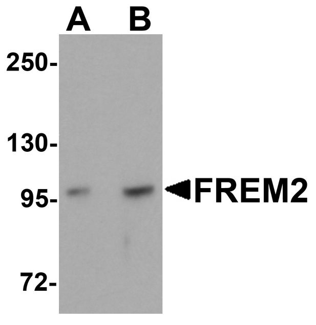 FREM2 Antibody - Western blot analysis of FREM2 in A-20 cell lysate with FREM2 antibody at (A) 0.5 and (B) 1ug/ml.