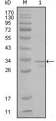 FRK Antibody - Western blot using FRK mouse monoclonal antibody against truncated FRK-His recombinant protein (1).