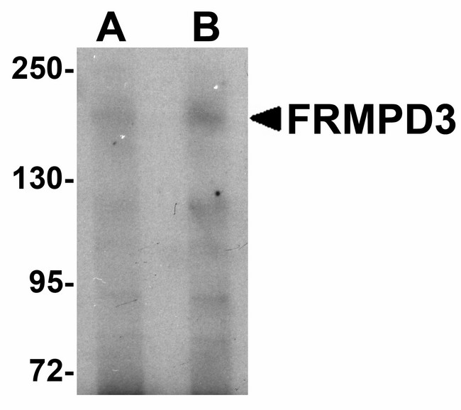 FRMPD3 Antibody - Western blot of FRMPD3 in Jurkat cell lysate with FRMPD3 antibody at (A) 1 and (B) 2 ug/ml.