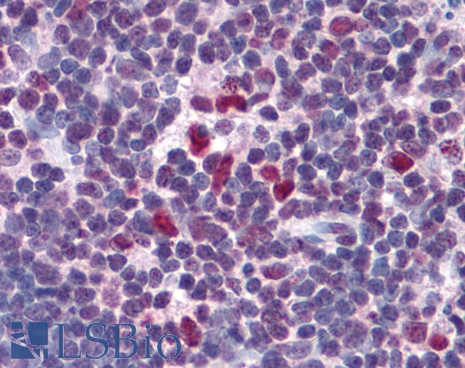 FRMPD3 Antibody - Anti-FRMPD3 antibody IHC of human thymus. Immunohistochemistry of formalin-fixed, paraffin-embedded tissue after heat-induced antigen retrieval. Antibody concentration 5 ug/ml.
