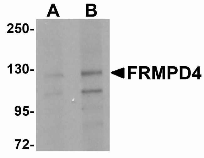 FRMPD4 Antibody - Western blot of FRMPD4 in SK-N-SH cell lysate with FRMPD4 antibody at (A) 1 and (B) 2 ug/ml.