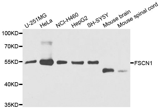 FSCN1 / Fascin Antibody - Western blot blot of extracts of various cell lines, using FSCN1 antibody.
