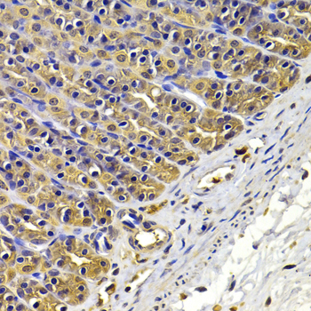 FSCN1 / Fascin Antibody - Immunohistochemistry of paraffin-embedded rat stomach using FSCN1 antibody at dilution of 1:100 (x400 lens).