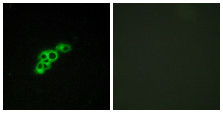 FSH Receptor / FSHR Antibody - Immunofluorescence analysis of MCF7 cells, using FSHR Antibody. The picture on the right is blocked with the synthesized peptide.