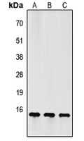 FSHB / FSH Beta Antibody - Western blot analysis of FSH beta expression in HeLa (A); Raw264.7 (B); PC12 (C) whole cell lysates.