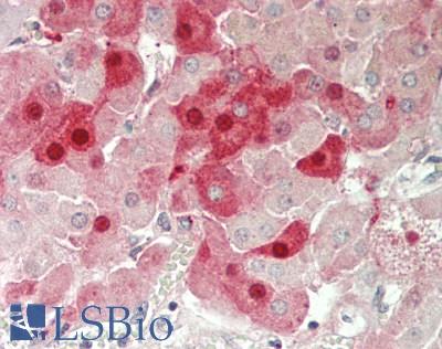 FSHB / FSH Beta Antibody - Human Adrenal: Formalin-Fixed, Paraffin-Embedded (FFPE)