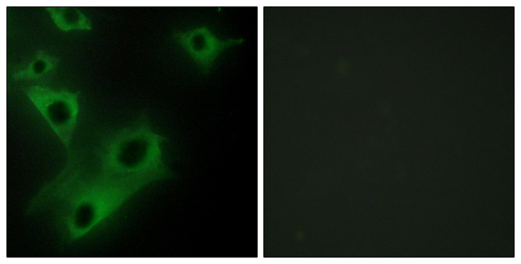 FSP27 / CIDEC Antibody - Immunofluorescence analysis of HeLa cells, using CIDEC Antibody. The picture on the right is blocked with the synthesized peptide.