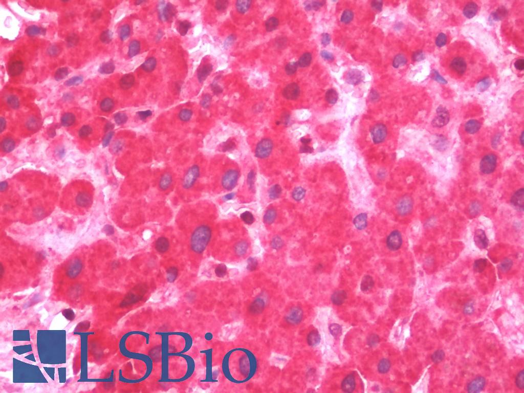 FSP27 / CIDEC Antibody - Anti-FSP27 / CIDEC antibody IHC staining of human liver. Immunohistochemistry of formalin-fixed, paraffin-embedded tissue after heat-induced antigen retrieval. Antibody concentration 7.5 ug/ml.