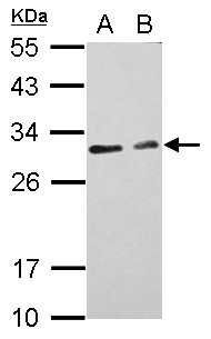 FSP27 / CIDEC Antibody - Sample (30 ug of whole cell lysate) A: HeLa B: HepG2 12% SDS PAGE CIDEC / FSP27 antibody diluted at 1:1000