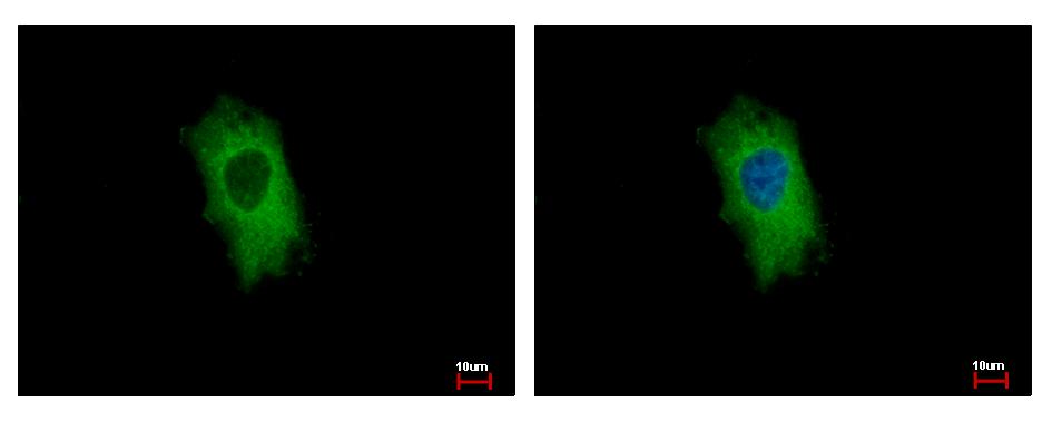 FSP27 / CIDEC Antibody - CIDEC antibody detects CIDEC protein at cytoplasm by immunofluorescent analysis. HeLa cells were fixed in 4% paraformaldehyde at RT for 15 min. CIDEC protein stained by CIDEC antibody diluted at 1:500.