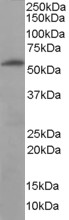 FTCD / 58K Golgi Protein Antibody - FTCD / 58K Golgi Protein antibody (0.1ug/ml) staining of Human Liver lysate (35ug protein in RIPA buffer). Detected by chemiluminescence.