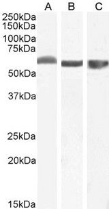 FTCD / 58K Golgi Protein Antibody - 58KGolgi protein(Internal)/FTCD Antibody (0.1µg/ml) staining of Human (A), (0.03ug/ml) of Mouse (B) and (0.3ug/ml) of Pig (C) Liver lysate (35µg protein in RIPA buffer). Detected by chemiluminescencence.
