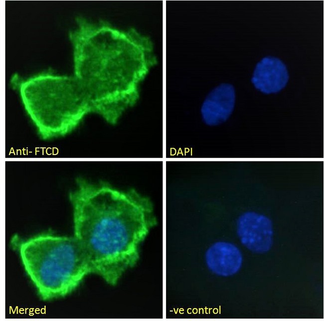 FTCD / 58K Golgi Protein Antibody - 58KGolgi protein(Internal)/FTCD Antibody Immunofluorescence analysis of paraformaldehyde fixed HepG2 cells, permeabilized with 0.15% Triton. Primary incubation 1hr (10ug/ml) followed by Alexa Fluor 488 secondary antibody (2ug/ml), showing plasma membrane staining. The nuclear stain is DAPI (blue). Negative control: Unimmunized goat IgG (10ug/ml) followed by Alexa Fluor 488 secondary antibody (2ug/ml).