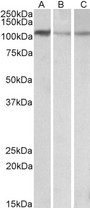 FTHFSDC1 / MTHFD1L Antibody - FTHFSDC1 / MTHFD1L antibody (0.1µg/ml) staining of NIH3T3 (A), Mouse Brain (B) and Rat Brain (C) lysates (35µg protein in RIPA buffer). Detected by chemiluminescence.