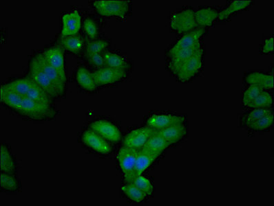FTL / Ferritin Light Chain Antibody - Immunofluorescent analysis of HepG2 cells using FTL Antibody at dilution of 1:100 and Alexa Fluor 488-congugated AffiniPure Goat Anti-Rabbit IgG(H+L)