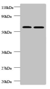 FUCA2 Antibody - Western blot All lanes: Plasma alpha-L-fucosidase antibody at 2µg/ml Lane 1: EC109 whole cell lysate Lane 2: 293T whole cell lysate Secondary Goat polyclonal to rabbit IgG at 1/10000 dilution Predicted band size: 55, 20 kDa Observed band size: 55 kDa