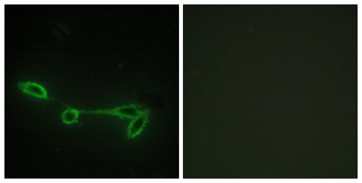 FUK Antibody - Immunofluorescence analysis of NIH/3T3 cells, using FUK Antibody. The picture on the right is blocked with the synthesized peptide.