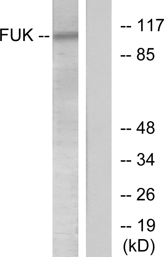 FUK Antibody - Western blot analysis of lysates from COS7 cells, treated with insulin 0.01U/ml 45', using FUK Antibody. The lane on the right is blocked with the synthesized peptide.