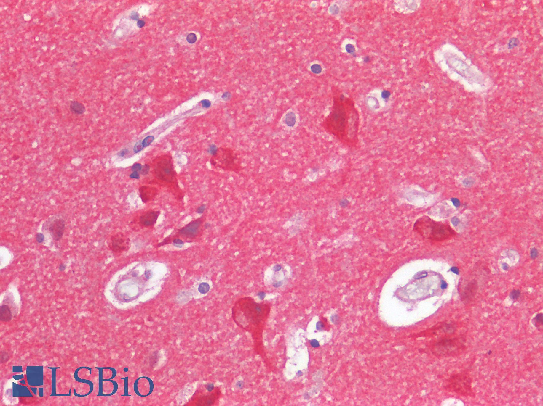 FURIN Antibody - Human Brain, Cortex: Formalin-Fixed, Paraffin-Embedded (FFPE)