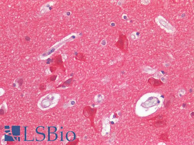 FURIN Antibody - Human Brain, Cortex: Formalin-Fixed, Paraffin-Embedded (FFPE)