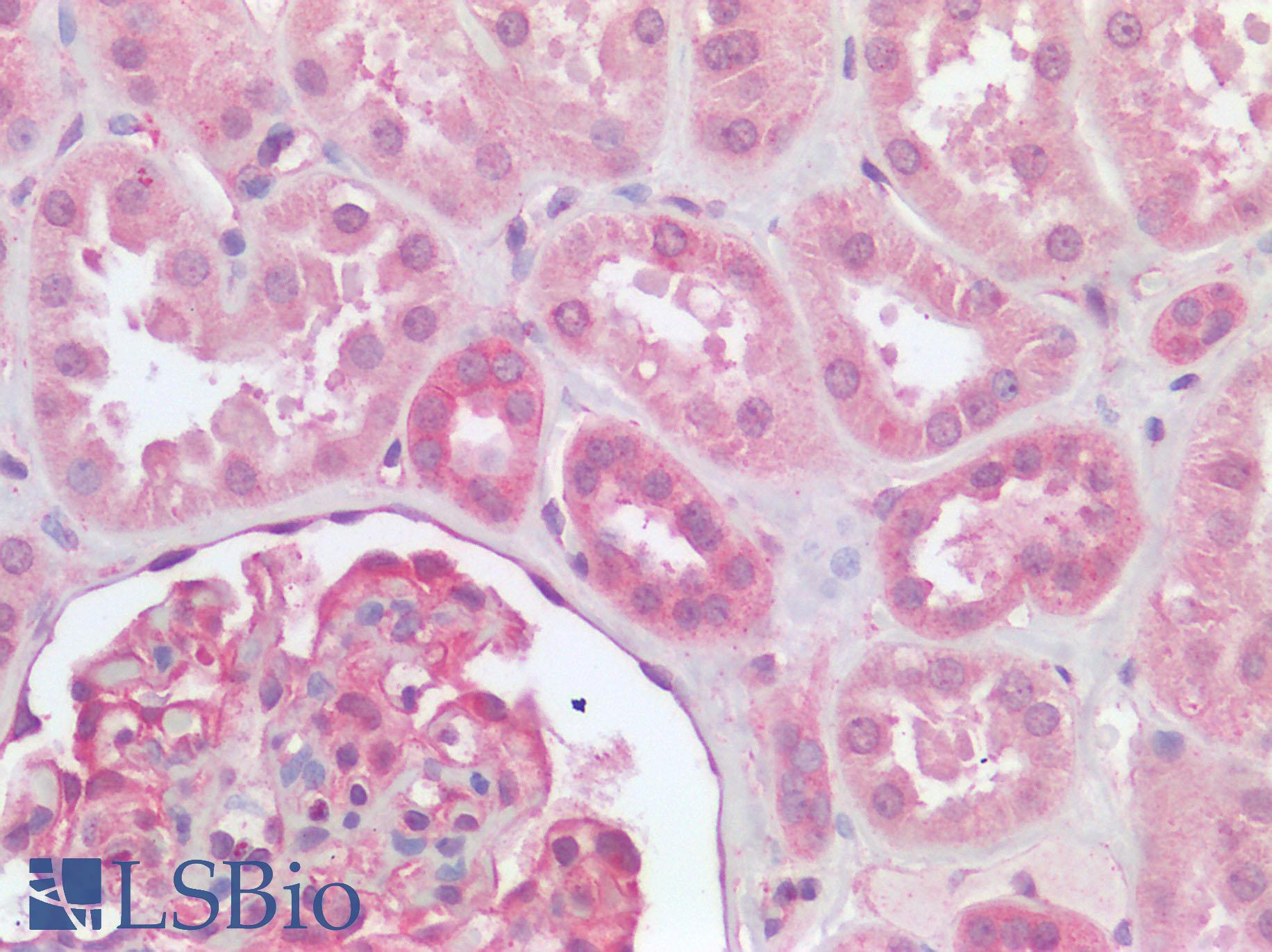 FURIN Antibody - Human Kidney: Formalin-Fixed, Paraffin-Embedded (FFPE)