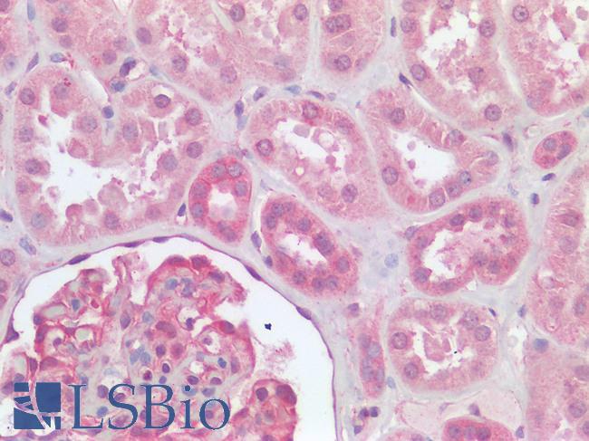 FURIN Antibody - Human Kidney: Formalin-Fixed, Paraffin-Embedded (FFPE)