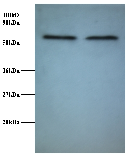 FUS / TLS Antibody - Western blot of RNA-binding protein FUS antibody at 2 ug/ml. Lane 1:293T whole cell lysate. Lane 2: EC109 whole cell lysate. Secondary: Goat polyclonal to Rabbit IgG at 1:15000 dilution. Predicted band size: 60 kDa. Observed band size: 60 kDa.