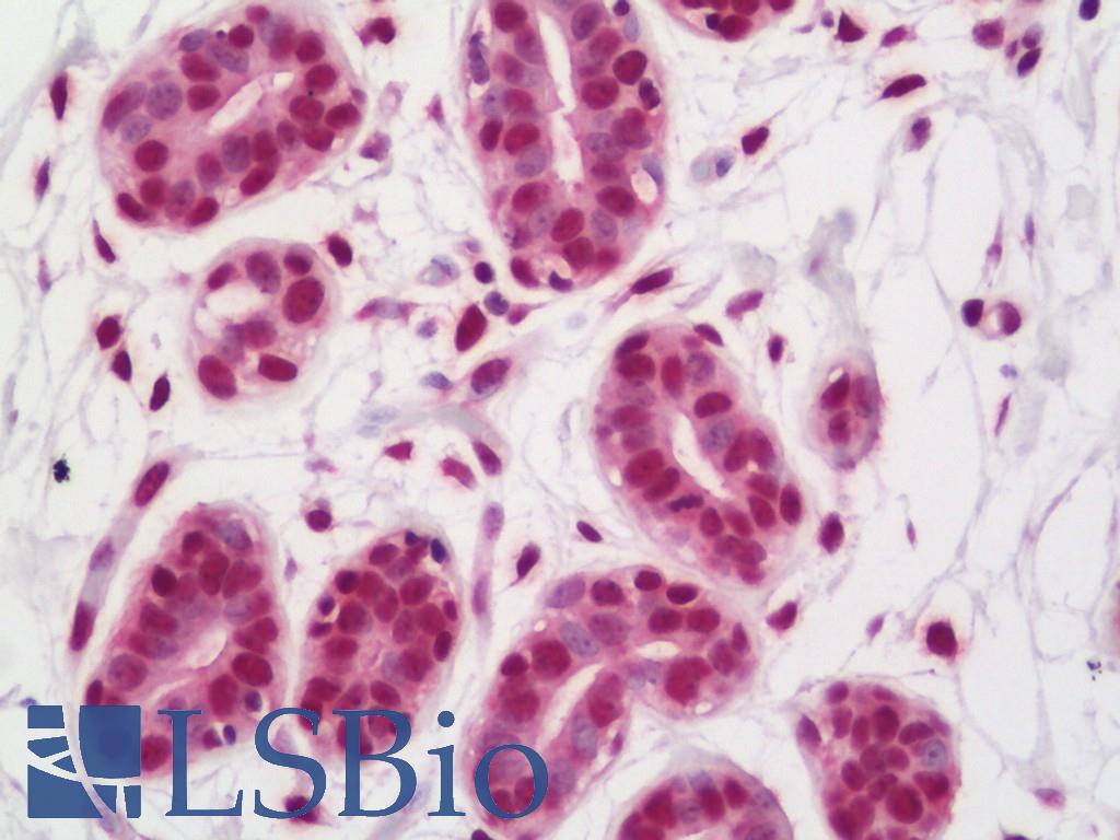 FUS / TLS Antibody - Anti-FUS / Gadd153 antibody IHC staining of human breast. Immunohistochemistry of formalin-fixed, paraffin-embedded tissue after heat-induced antigen retrieval. Antibody concentration 20 ug/ml.