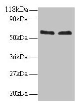 FUS / TLS Antibody - Western blot All lanes: RNA-binding protein FUS antibody at 2µg/ml Lane 1: 293T whole cell lysate Lane 2: EC109 whole cell lysate Secondary Goat polyclonal to rabbit IgG at 1/15000 dilution Predicted band size: 60 kDa Observed band size: 60 kDa