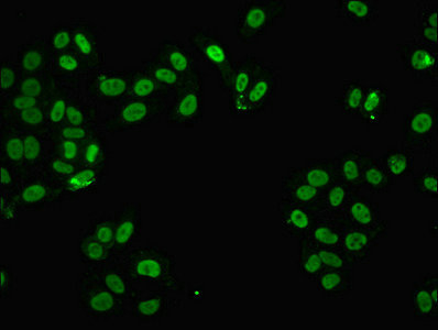FUS / TLS Antibody - Immunofluorescent analysis of HepG2 cells using FUS Antibody at dilution of 1:100 and Alexa Fluor 488-congugated AffiniPure Goat Anti-Rabbit IgG(H+L)