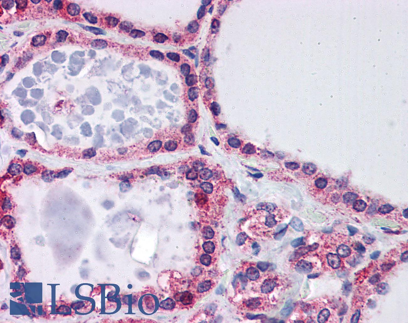 FXN / Frataxin Antibody - Anti-FXN / Frataxin antibody IHC of human thyroid. Immunohistochemistry of formalin-fixed, paraffin-embedded tissue after heat-induced antigen retrieval. Antibody concentration 5 ug/ml.  This image was taken for the unconjugated form of this product. Other forms have not been tested.