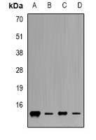 FXN / Frataxin Antibody - Western blot analysis of Frataxin expression in Jurkat (A); K562 (B); mouse heart (C); mouse liver (D) whole cell lysates.
