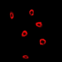 FXN / Frataxin Antibody - Immunofluorescent analysis of Frataxin staining in MCF7 cells. Formalin-fixed cells were permeabilized with 0.1% Triton X-100 in TBS for 5-10 minutes and blocked with 3% BSA-PBS for 30 minutes at room temperature. Cells were probed with the primary antibody in 3% BSA-PBS and incubated overnight at 4 deg C in a humidified chamber. Cells were washed with PBST and incubated with a DyLight 594-conjugated secondary antibody (red) in PBS at room temperature in the dark.