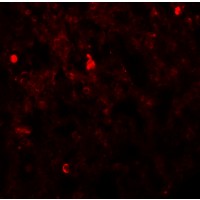 FXYD7 Antibody - Immunofluorescence of FXYD4 in rat lung tissue with FXYD4 antibody at 20 µg/mL.