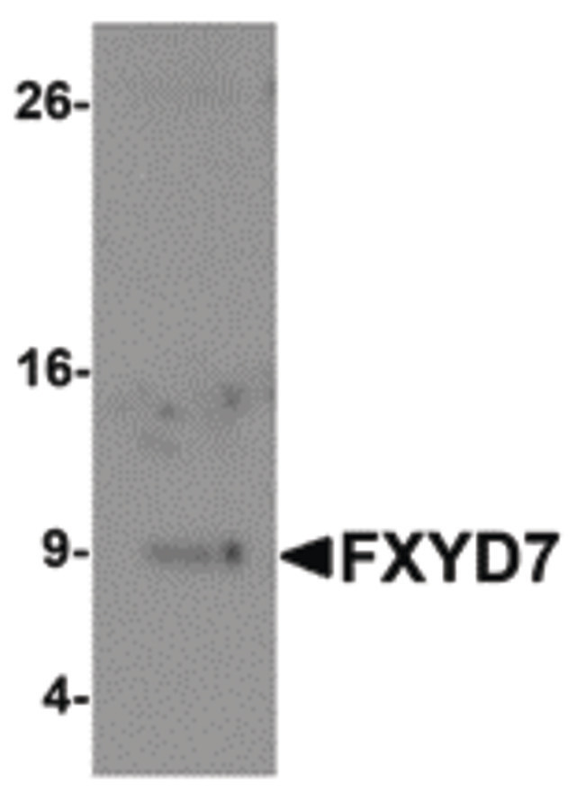 FXYD7 Antibody - Western blot of FXYD7 in human lung tissue lysate with FXYD7 antibody at 1 ug/ml.