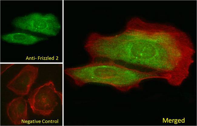 FZD2 / Frizzled 2 Antibody - Frizzled 2 Antibody Immunofluorescence analysis of paraformaldehyde fixed U2OS cells, permeabilized with 0.15% Triton. Primary incubation 1hr (10ug/ml) followed by Alexa Fluor 488 secondary antibody (2ug/ml), showing nuclear and cytoplasmic staining. Actin filaments were stained with phalloidin (red). Negative control: Unimmunized goat IgG (10ug/ml) followed by Alexa Fluor 488 secondary antibody (2ug/ml).