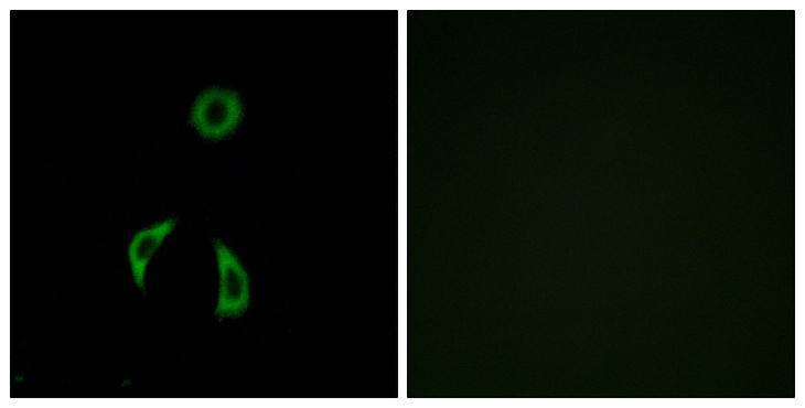 FZD3 / Frizzled 3 Antibody - Immunofluorescence analysis of A549 cells, using FZD3 Antibody. The picture on the right is blocked with the synthesized peptide.