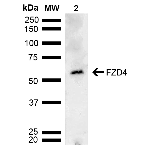 FZD4 / Frizzled 4 Antibody - Western blot analysis of Mouse testis lysate showing detection of ~59.9 kDa FZD4 protein using Rabbit Anti-FZD4 Polyclonal Antibody. Lane 1: Molecular Weight Ladder (MW). Lane 2: Mouse testis lysate. Load: 15 µg. Block: 5% Skim Milk in 1X TBST. Primary Antibody: Rabbit Anti-FZD4 Polyclonal Antibody  at 1:1000 for 2 hours at RT. Secondary Antibody: Goat Anti-Rabbit HRP:IgG at 1:4000 for 1 hour at RT. Color Development: ECL solution for 5 min at RT. Predicted/Observed Size: ~59.9 kDa.