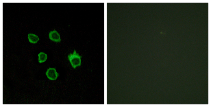 FZD5 / Frizzled 5 Antibody - Immunofluorescence analysis of COS7 cells, using FZD5 Antibody. The picture on the right is blocked with the synthesized peptide.