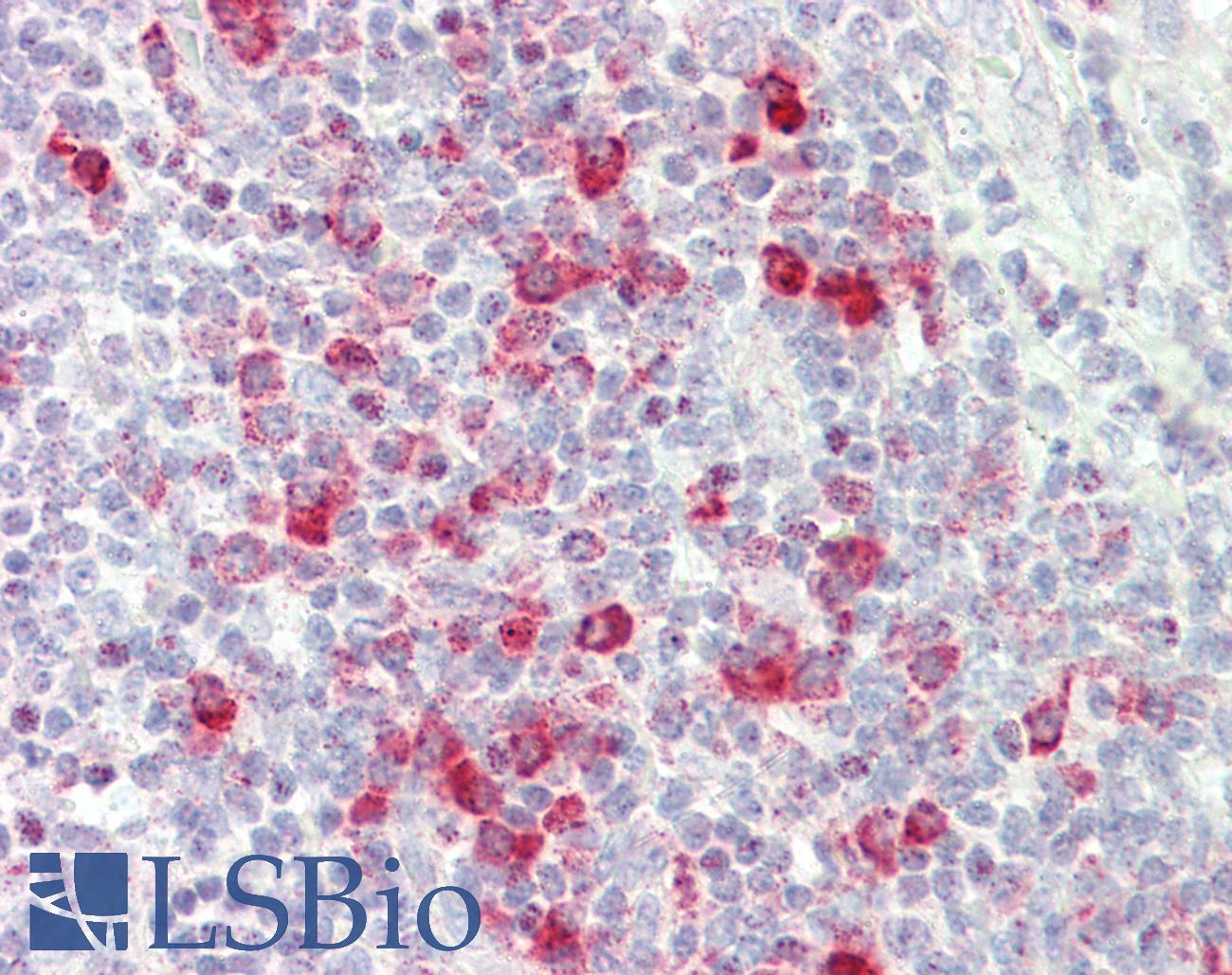 FZD5 / Frizzled 5 Antibody - Anti-FZD5 / Frizzled 5 antibody IHC staining of human tonsil. Immunohistochemistry of formalin-fixed, paraffin-embedded tissue after heat-induced antigen retrieval.