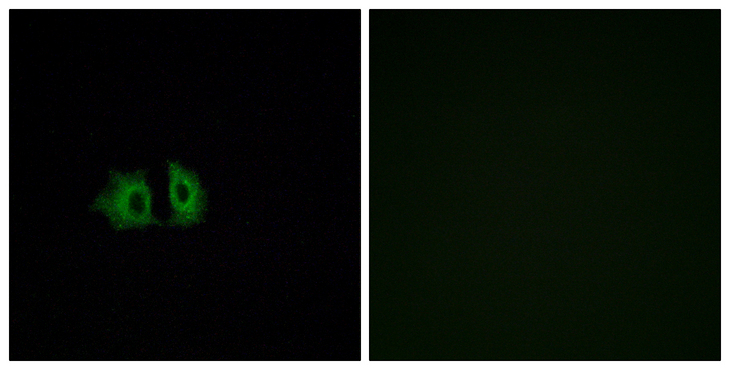 FZD5 / Frizzled 5 Antibody - Immunofluorescence analysis of A549 cells, using FZD5 Antibody. The picture on the right is blocked with the synthesized peptide.